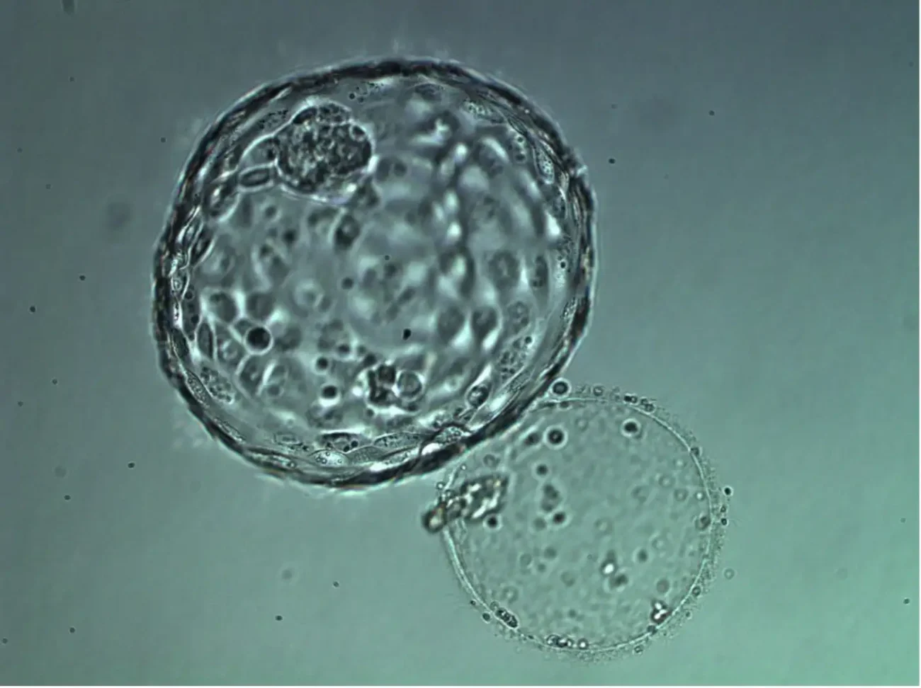 Day 6 blastocyst after biopsy and vitrifivation and thawing procedures, ready for embryo transfer.